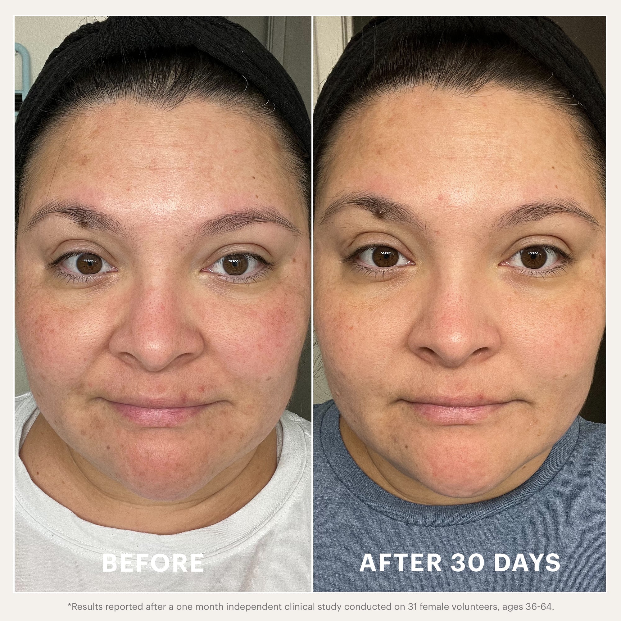 Renew Serum - Glo Skin Beauty