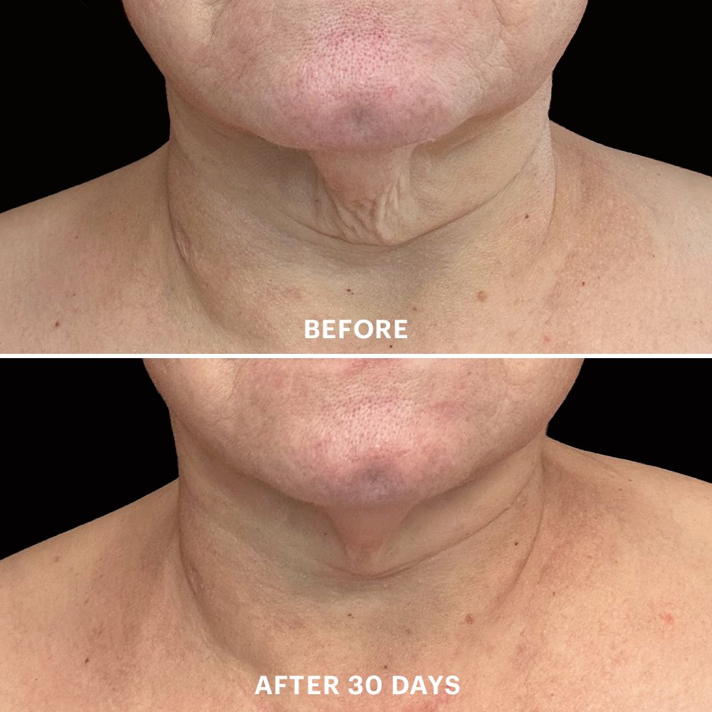 Bio-Renew EGF Neck Cream - Glo Skin Beauty
