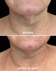 Bio-Renew EGF Neck Cream - Glo Skin Beauty